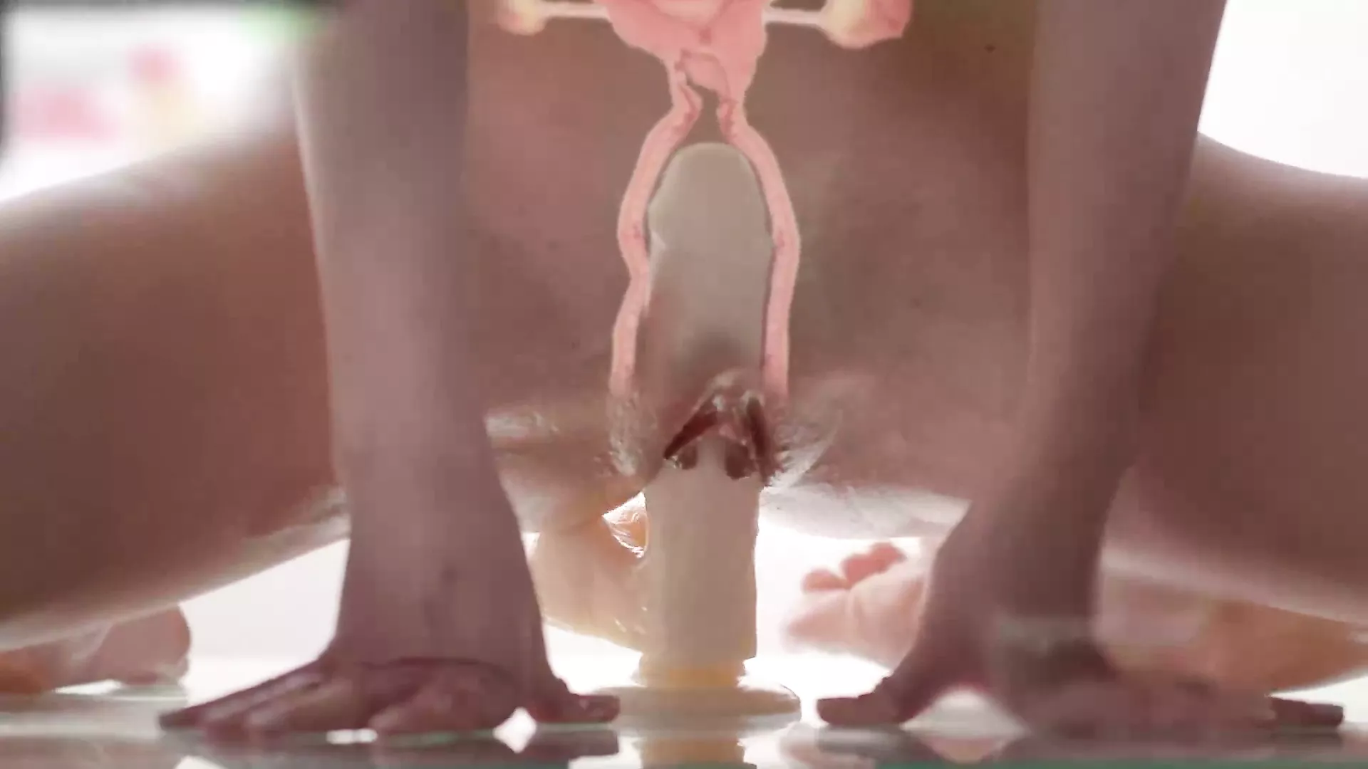 xray pussy 