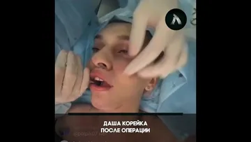 Даша Корейка в прямом эфире после операции | АКУЛА смотреть онлайн ...